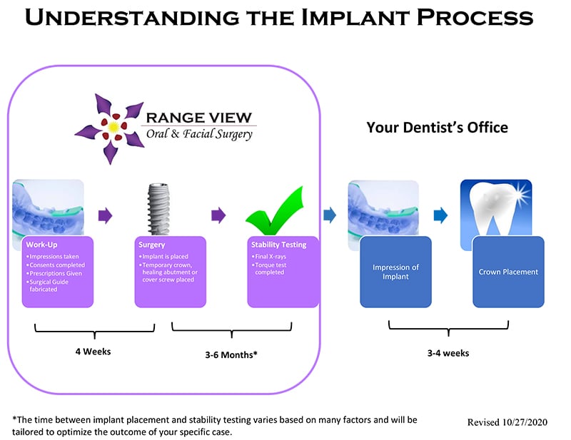 Understanding The Implant Process Flowsheet